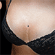 microdermal sul petto al centro del seno con gioiello in titanio G23